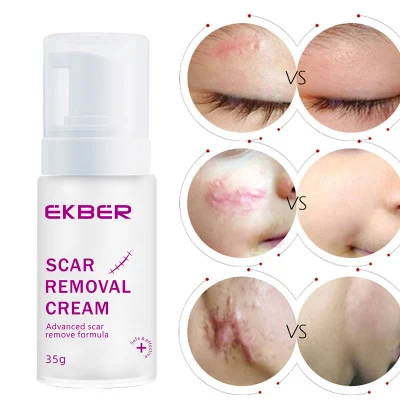 Cuidado de piel anti del acné de la crema eficaz facial natural pura del retiro de la cicatriz del OEM a granel
