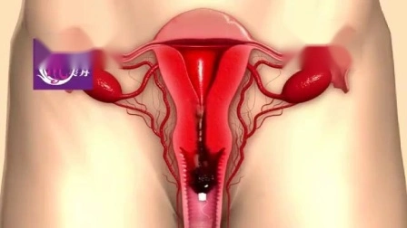 Womb Detox Vaginal Clean Point Tampon Producto de higiene femenina para mujeres